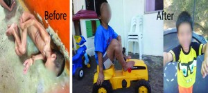 (Left Photo) Frederico before he was rescued from the Manila Reception Action Center (MRAC) in October 2014 by DSWD social workers. This photo was used by DailyMail Online in its January 15 article. (Right Photo) Frederico is now a healthy and happy boy after receiving rehabilitation services from an NGO and DSWD.